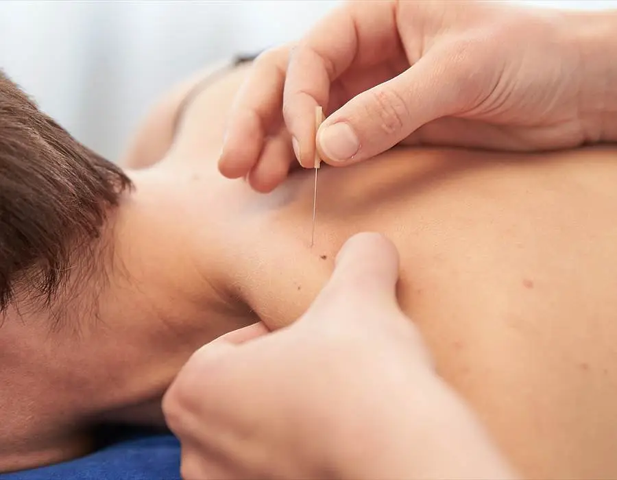 Close-up of a practitioner inserting a thin needle into a person’s neck during a dry needling treatment while the person lies face down.